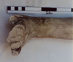 Detail der linken Hand